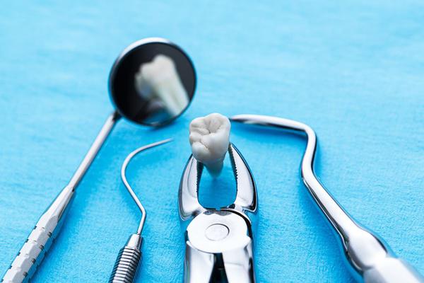 Tooth Extraction Silver Spring, MD
